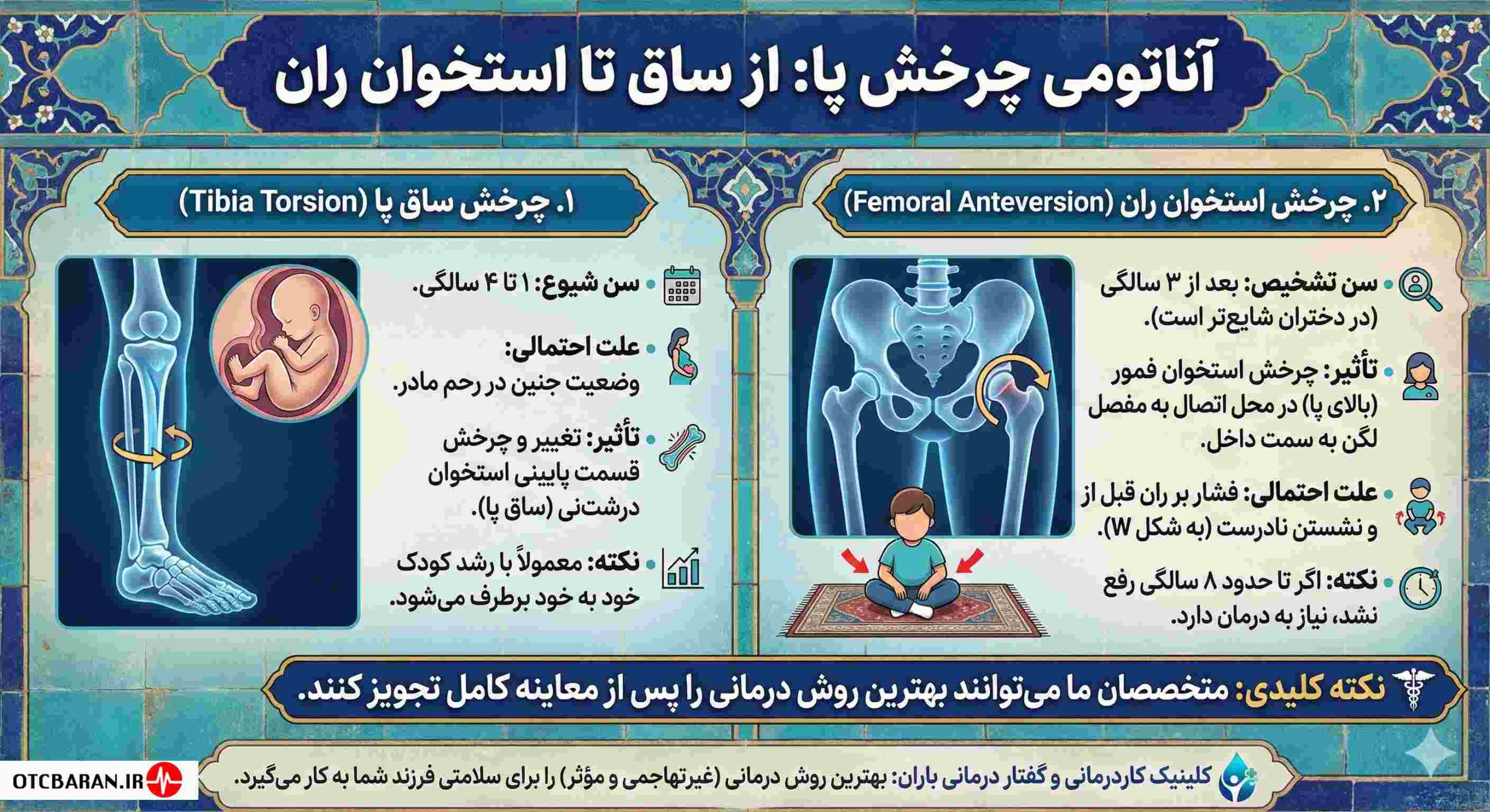 درمان چرخش پا به داخل در اراک